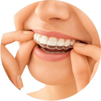 radiant smile with veneers